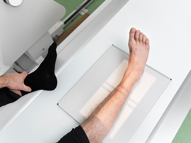 Essential Health Screenings for Women 4 Scientific diagram of bone density test or illustration or can show image of bone