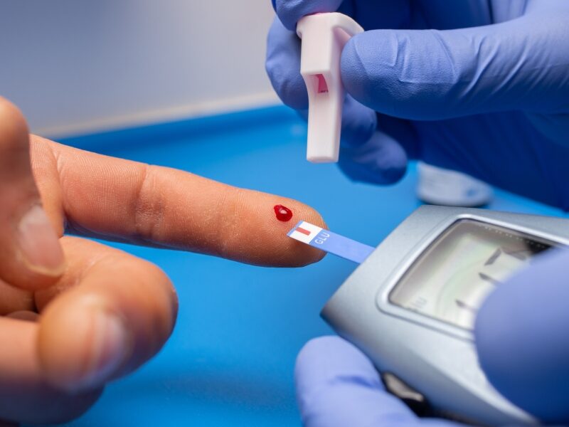 Best 5 Ways to Get Vitamin D Without Excessive Sunlight 6 Image show a finger is getting pricked by healthcare worker in order to check the blood sample for test in blood sampling machine.