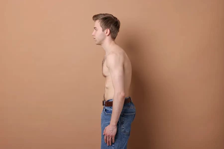 Yoga for Kyphosis