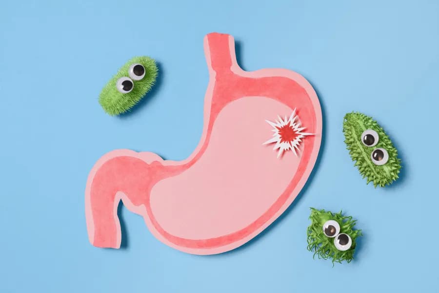 Yoga for Stomach Ulcer: Reduce Stress, Soothe the Gut and Support Healing