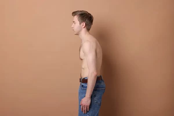 Yoga for Kyphosis